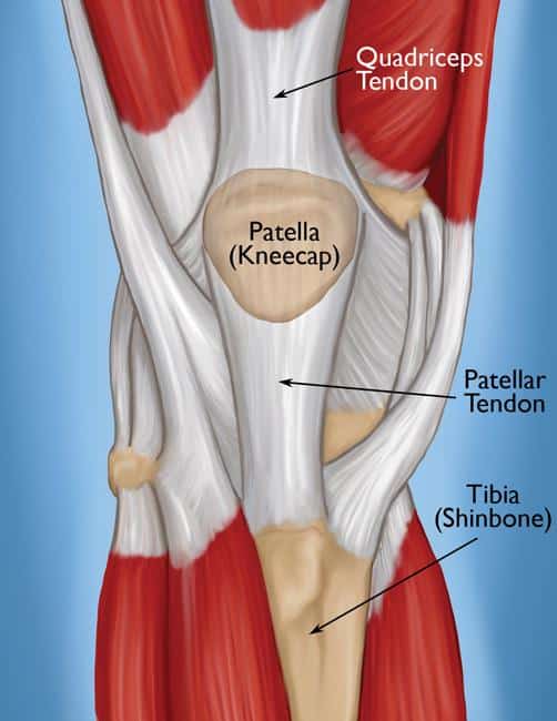 Anatomical illustration of the knee showing the quadriceps tendon, patella, patellar tendon, and tibia